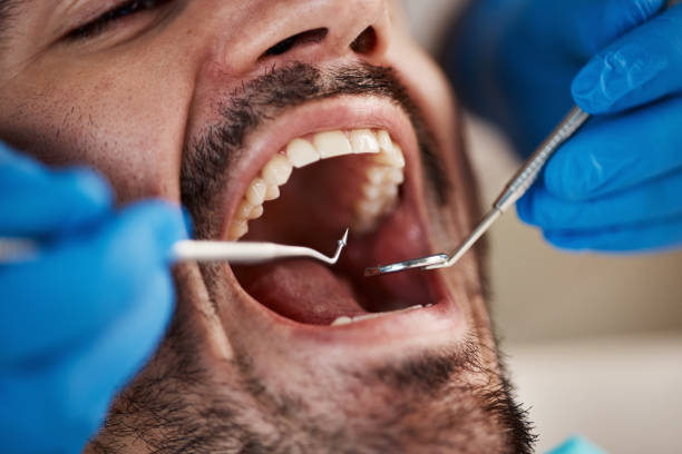 Best Emergency Dental Services Near Me  in Calhoun City, MS